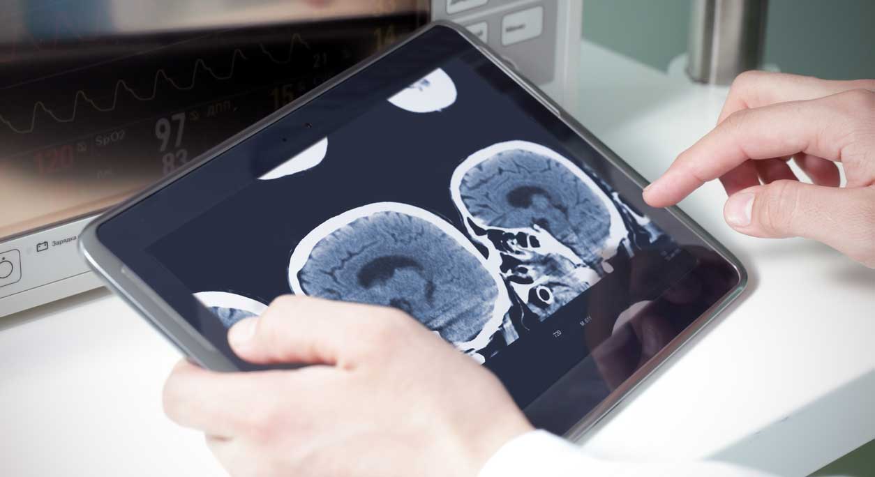 A doctor's hands holding a tablet that displays brain scans.