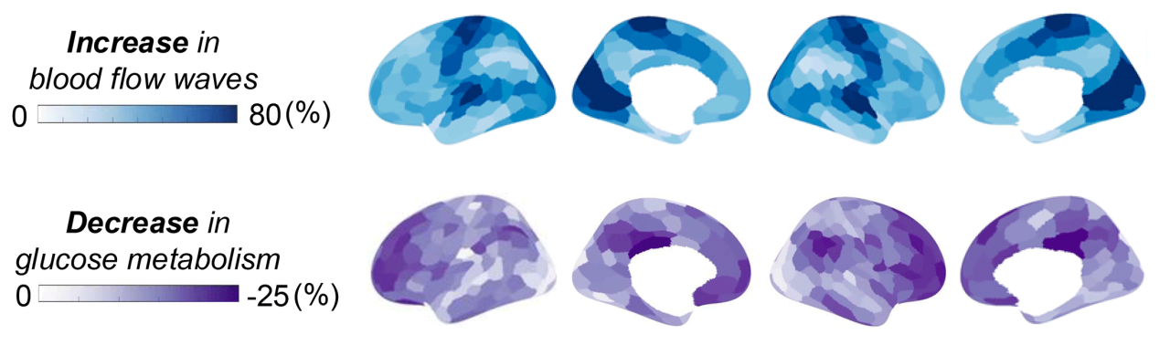 How the brain's activity, energy use and blood flow change as people fall asleep