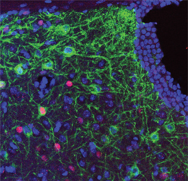 Scan of brain cells with the cells colored blue and pink, and the connections between them in green.