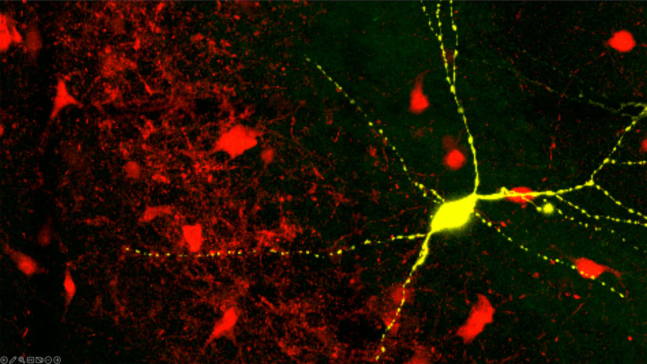 Shown in yellow, a parvalbumin interneuron in hippocampal CA3/CA2.