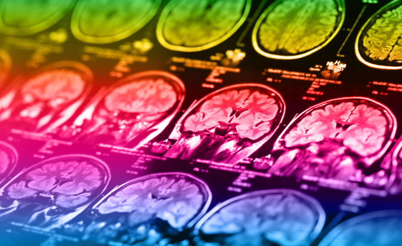 The X-ray of the human brain