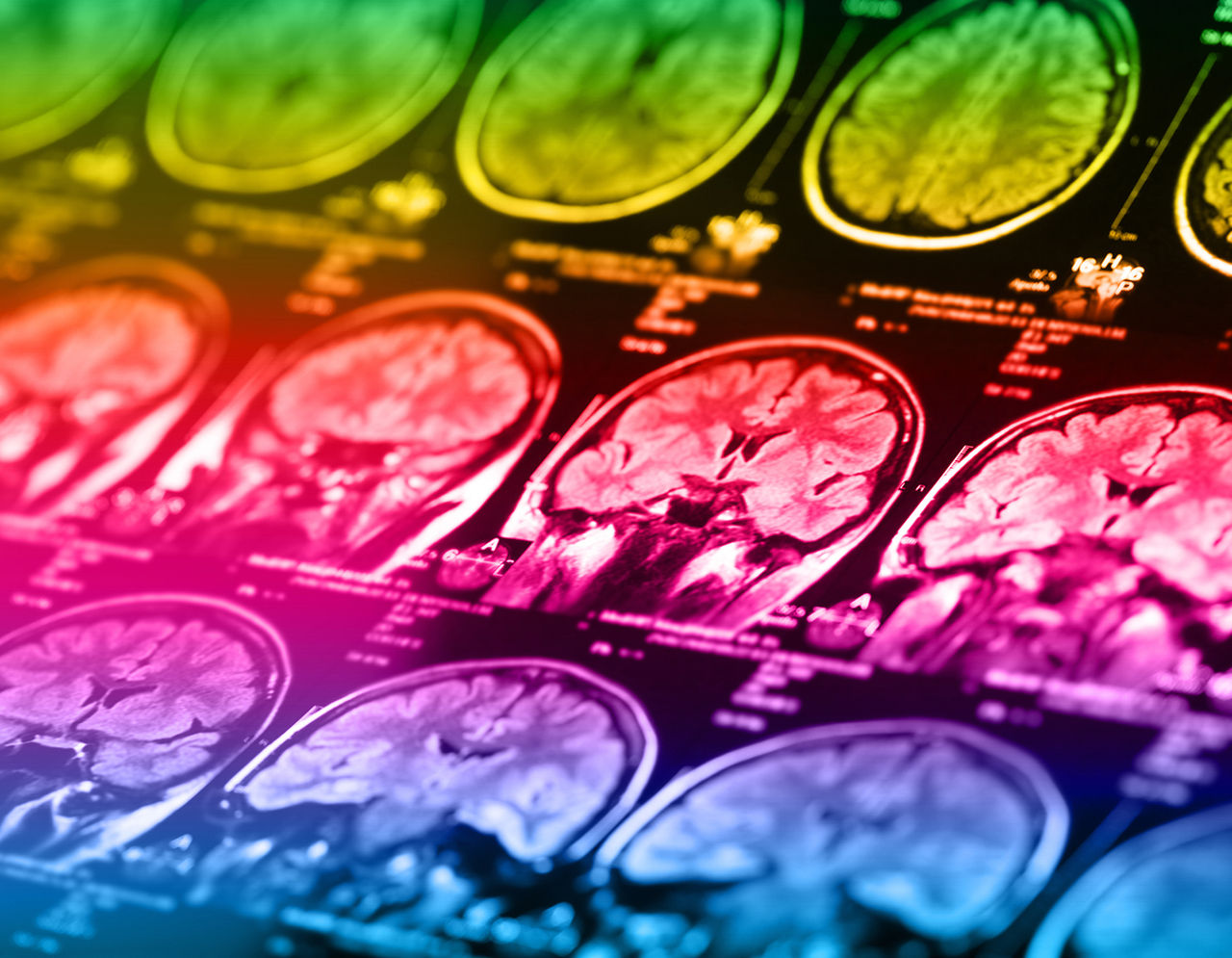 Scans of brains with rainbow colors 