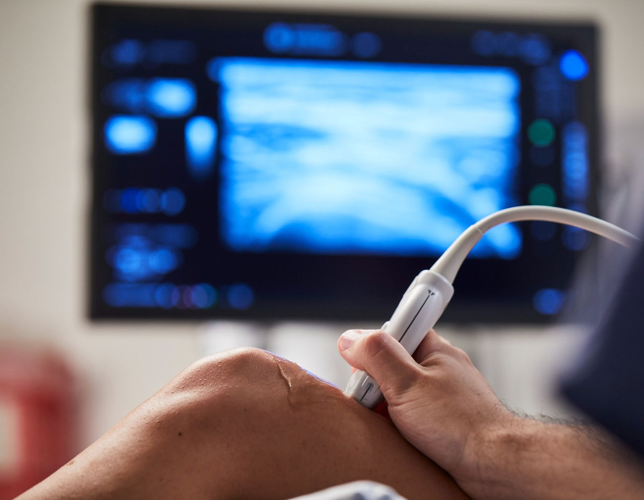 Provider performing an ultrasound on a patient’s knee 