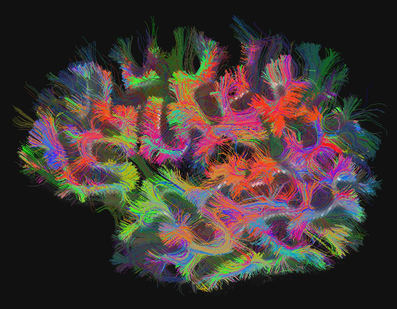 A map of brain connections computed from a diffusion MRI (dMRI) scan.
