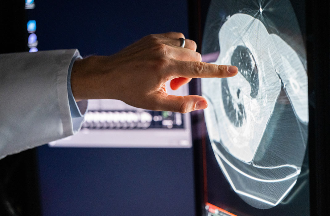 Lecia Sequist, MD, MPH pointing to an image on a screen