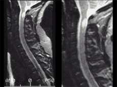 MS Diagnosis Figure