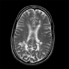 MS Figure Diagnosis