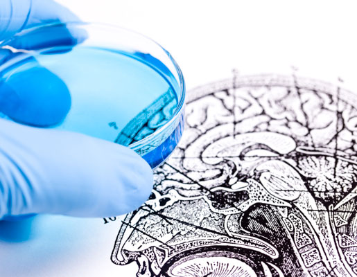 Hand placing petri dish on medical brain diagram